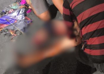 URGENTE: Menino de 10 anos perde o pé ao ser atropelado por carro no Novo Aleixo; VEJA