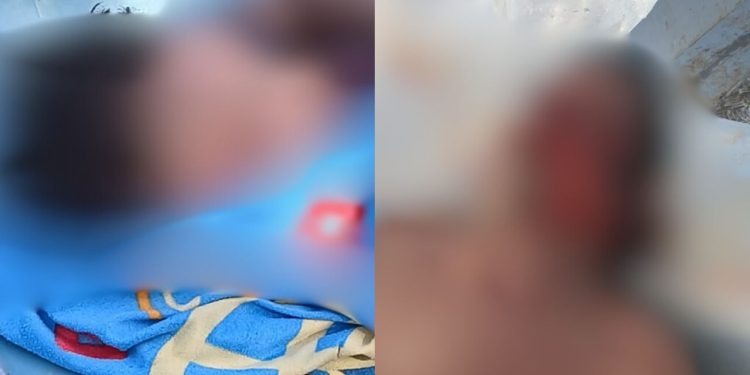 Ribeirinhos morrem e ficam com os rostos desfigurados após colisão entre canoas no Amazonas