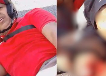 Vídeo forte mostra motociclista que ficou com a perna dilacerada em acidente em Manaus