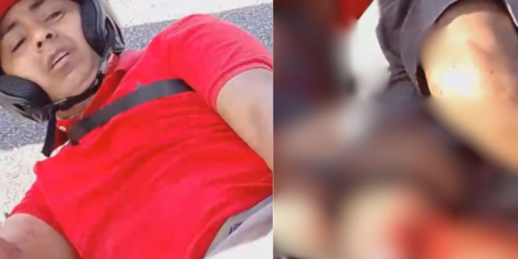Vídeo forte mostra motociclista que ficou com a perna dilacerada em acidente em Manaus