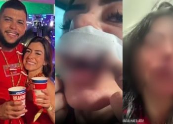 Vídeo forte: Cantor de Manacapuru quebra os dentes da namorada com socos após crise de ciúmes