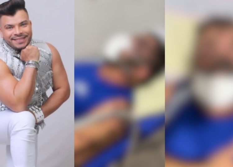 Veja como ficou o cantor paraense que morreu pelo vírus monkeypox, a 'varíola do macaco'