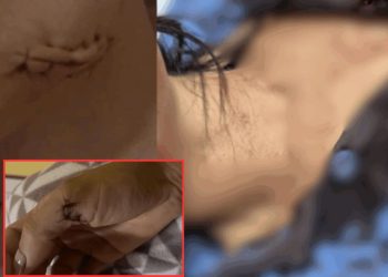 Esfaqueada ao chegar em casa em Manaus, mulher acusa ex-companheiro