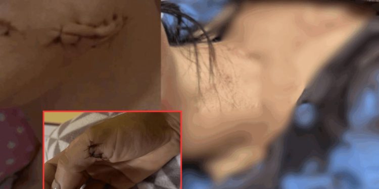 Esfaqueada ao chegar em casa em Manaus, mulher acusa ex-companheiro