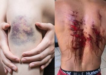 “Talaricagem”! Casal de amantes é agredido com pauladas pelo tribunal do crime