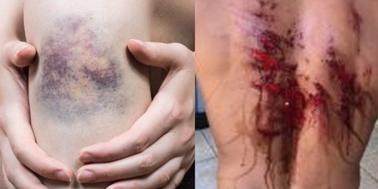 “Talaricagem”! Casal de amantes é agredido com pauladas pelo tribunal do crime