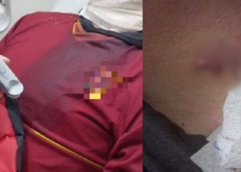 Aluno de 15 anos é esfaqueado no pescoço dentro de escola em Manaus