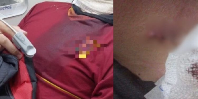 Aluno de 15 anos é esfaqueado no pescoço dentro de escola em Manaus