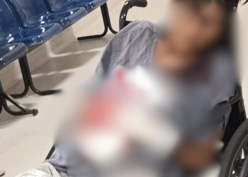 Com as mãos furadas de tiros, jovem de 18 anos é deixado no HPS 28 de Agosto