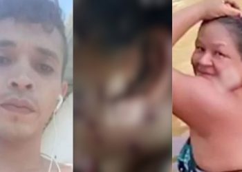 Veja como ficou o rosto da sogra que levou tiros de espingarda do genro em Itacoatiara