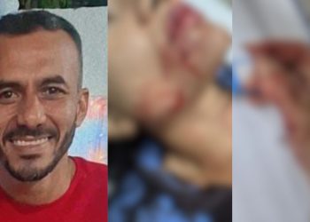 Covarde que passou a faca no rosto e mão da ex passa a ser procurado em Manaus