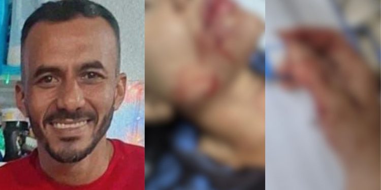 Covarde que passou a faca no rosto e mão da ex passa a ser procurado em Manaus