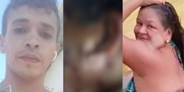 Veja como ficou o rosto da sogra que levou tiros de espingarda do genro em Itacoatiara