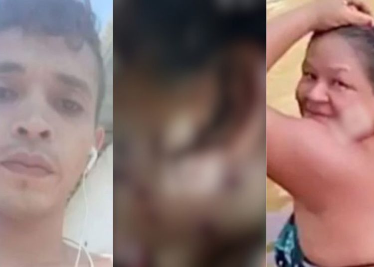 Veja como ficou o rosto da sogra que levou tiros de espingarda do genro em Itacoatiara