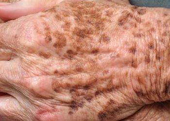 Cadáver é encontrado no bairro Morro da Liberdade