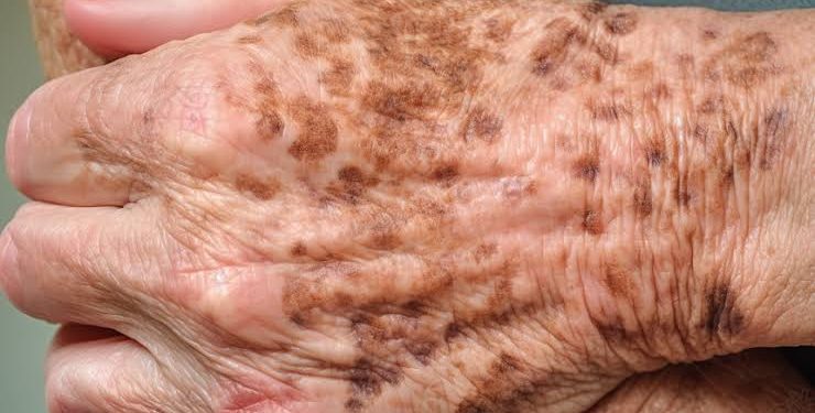 Cadáver é encontrado no bairro Morro da Liberdade