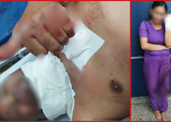 Briga de casal vira UFC e marido leva facada da esposa no pescoço