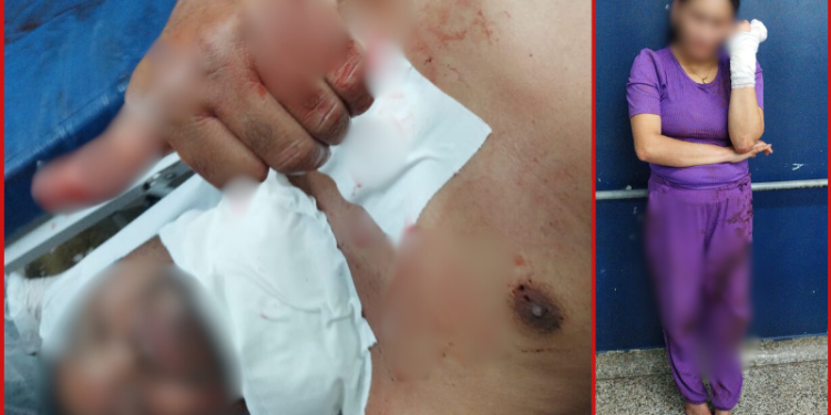 Briga de casal vira UFC e marido leva facada da esposa no pescoço