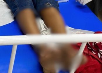 Enquanto caminhava, homem é baleado no Alvorada e acusa policial