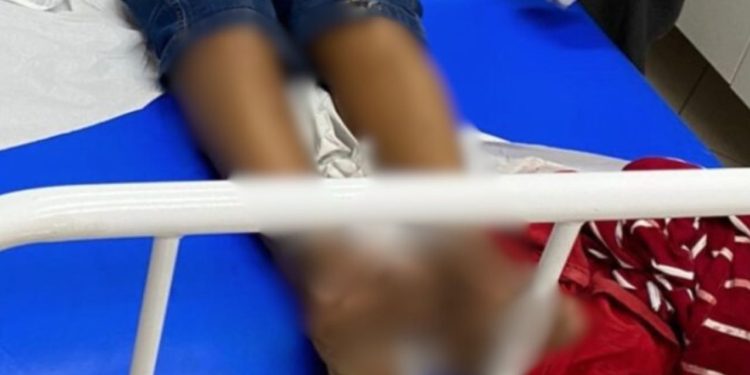 Enquanto caminhava, homem é baleado no Alvorada e acusa policial