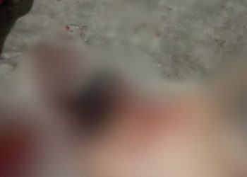 No Prosamim, jovem é assassinado com tiros na cabeça e costas