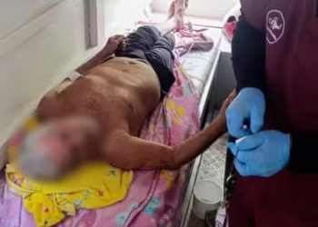 Após 9 dias sumido, idoso de 78 anos que saiu para pescar é achado no Amazonas