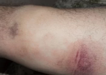 Humilhação em dobro – Foi assaltado e agredido no Santa Etelvina