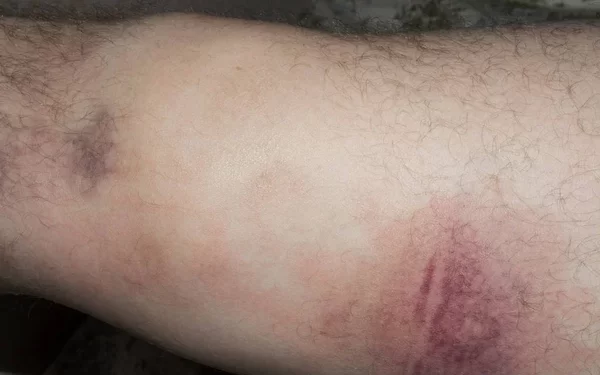 Humilhação em dobro – Foi assaltado e agredido no Santa Etelvina