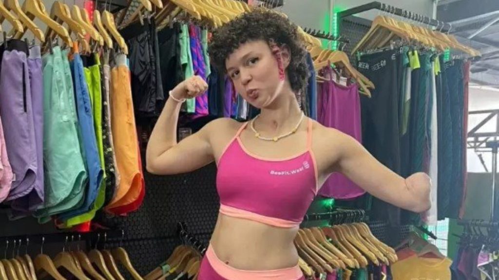 Após dores na barriga, influenciadora acaba com a perna e braço amputados 
