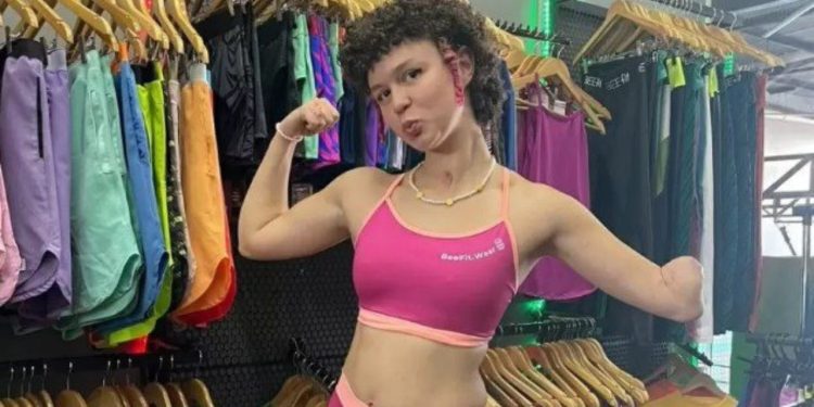 Após dores na barriga, influenciadora acaba com a perna e braço amputados 