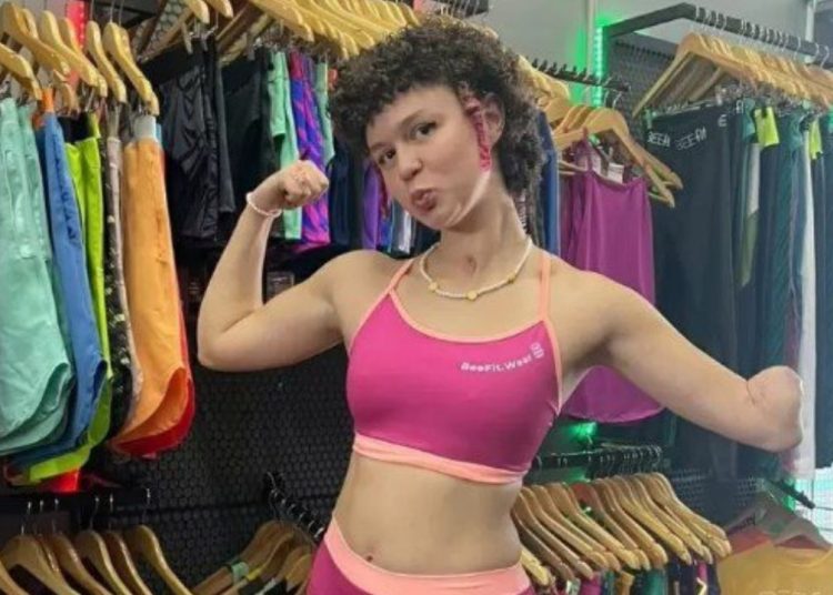 Após dores na barriga, influenciadora acaba com a perna e braço amputados