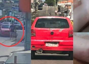 Pai atropelado com o filho na Compensa vai precisar passar por cirurgia; motorista tá foragido