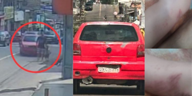Pai atropelado com o filho na Compensa vai precisar passar por cirurgia; motorista tá foragido
