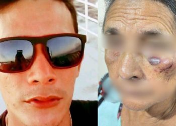 Em Parintins, filho deixa o rosto da mãe com hematomas após agredi-la com socos