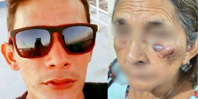Em Parintins, filho deixa o rosto da mãe com hematomas após agredi-la com socos