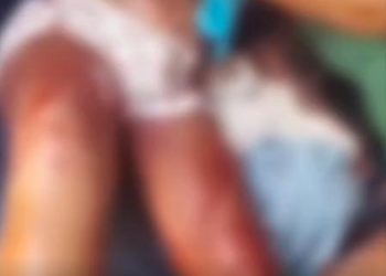 Grávida é esfaqueada pelo próprio companheiro na Zona Leste