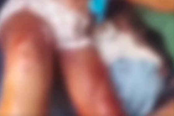 Grávida é esfaqueada pelo próprio companheiro na Zona Leste