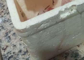 Homem tem mão d3c3pad@ e nariz perfurad0 durante briga brutal em Barreirinha