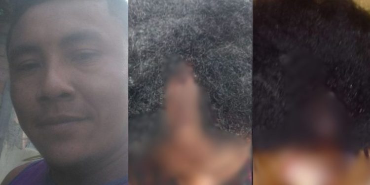 Veja: Em Urucurituba, marido acerta golpes de remo na cabeça da mulher e foge