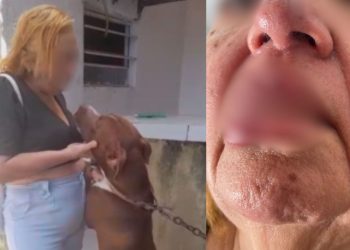VEJA: Ao dar ‘selinho’ em pitbull, mulher acaba com o lábio arrancado