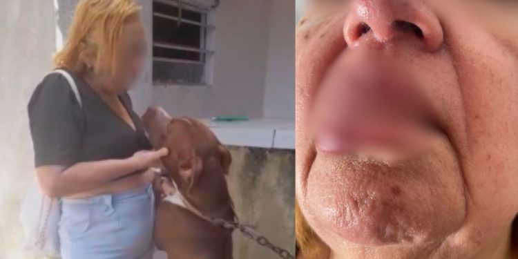 VEJA: Ao dar ‘selinho’ em pitbull, mulher acaba com o lábio arrancado