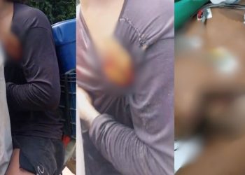 Estaca fica presa no tórax de jovem que derrubava árvores no interior do Amazonas