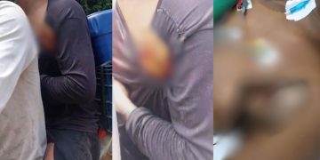 Estaca fica presa no tórax de jovem que derrubava árvores no interior do Amazonas