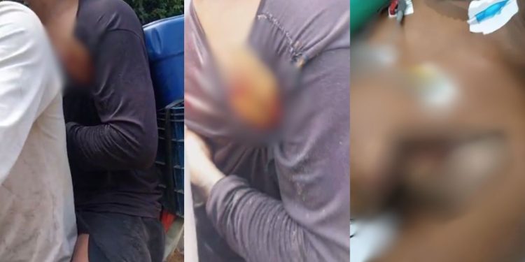 Estaca fica presa no tórax de jovem que derrubava árvores no interior do Amazonas