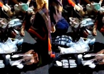 Estado grave: cliente que pegou choque em shopping de Manaus continua internado