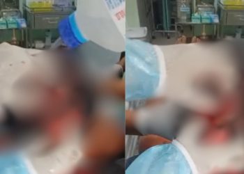 Ataque de onça deixa cacique com a cabeça aberta no interior do Amazonas