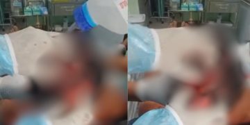 Ataque de onça deixa cacique com a cabeça aberta no interior do Amazonas