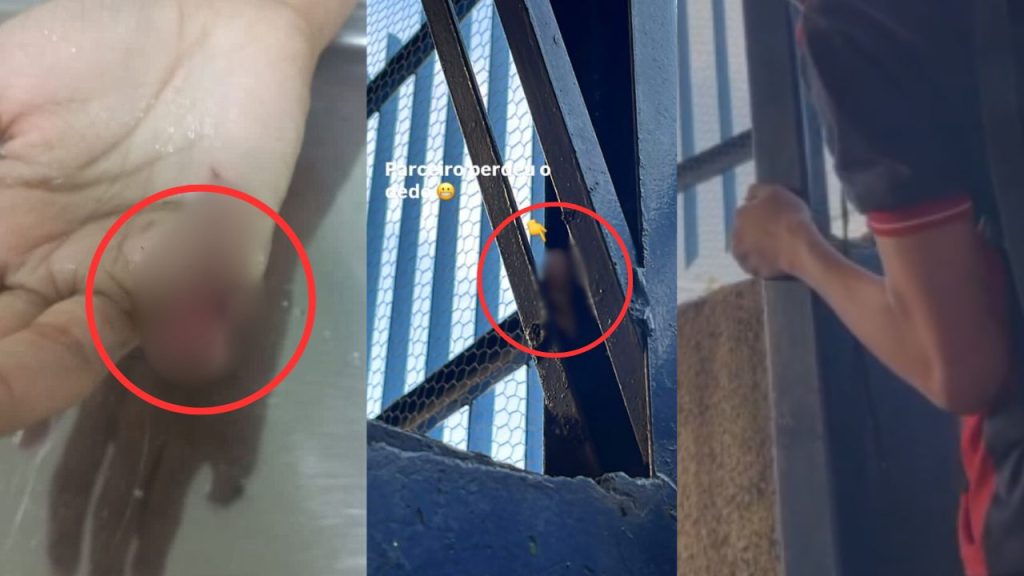 Estudante tem dedo amputado dentro de escola em Manaus