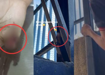 Estudante tem dedo amputado dentro de escola em Manaus