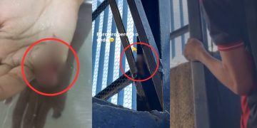 Estudante tem dedo amputado dentro de escola em Manaus